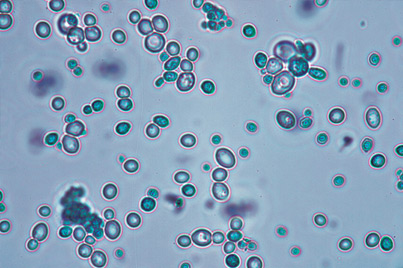 malolactic bacteria